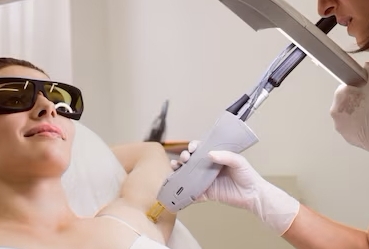Laser Hair Removal Treatments Walsall